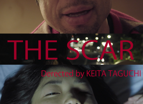 the scar